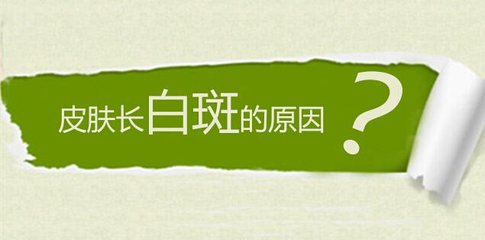 盐城白癜风医院分析脸上长白癜风的原因